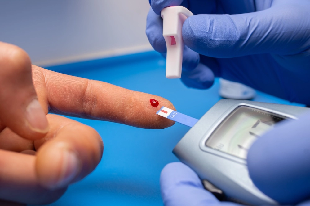 Cholesterol Testing: When to Check It and What the Numbers Mean