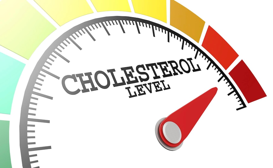 The Ultimate Guide to Monitoring Your Cholesterol Levels – When to Start and Why”